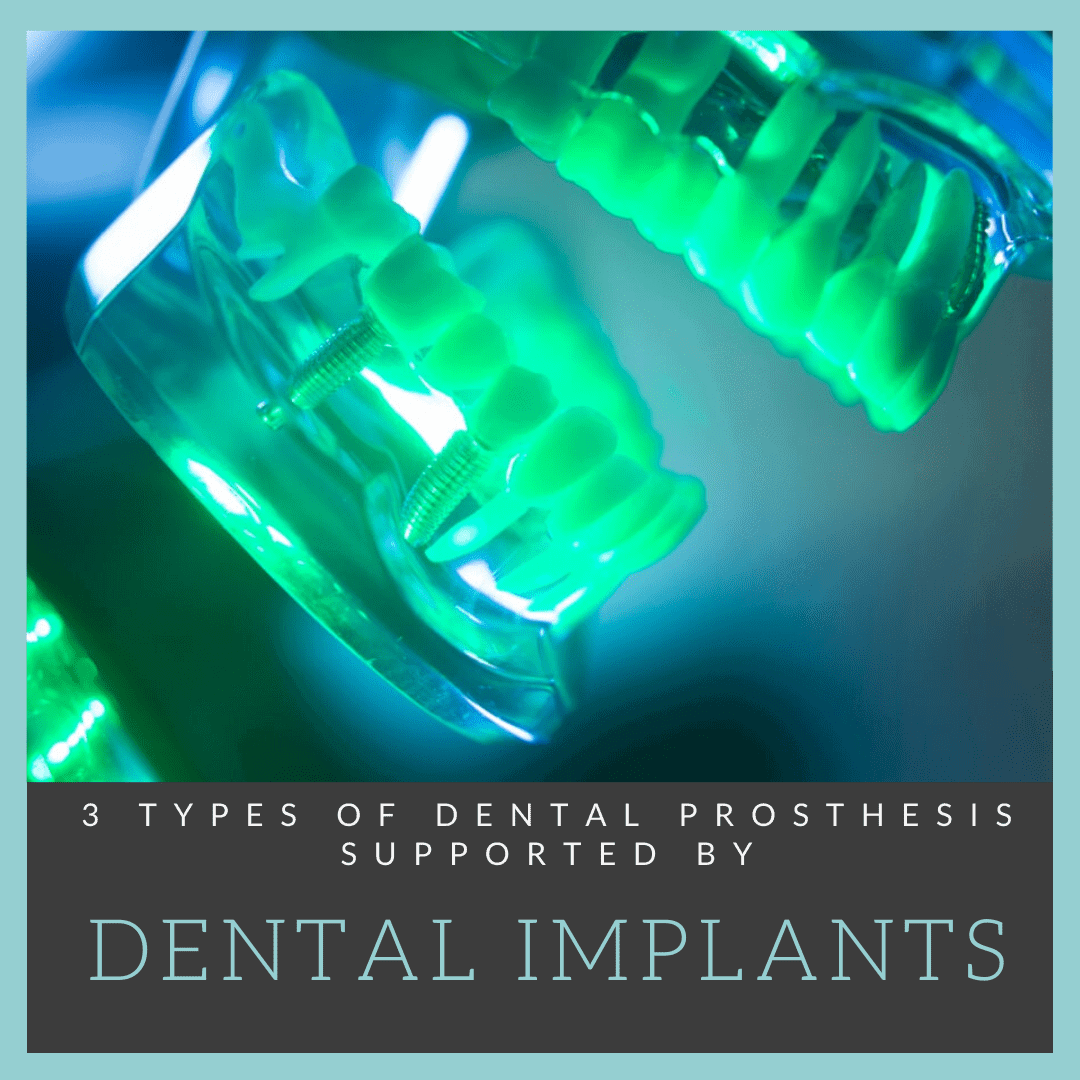 3-types-of-dental-prosthesis-laurich-dentistry